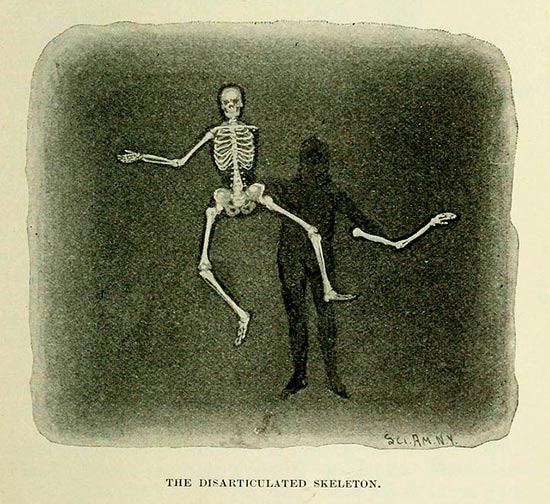 Read more about the article The Disarticulated Skeleton Magic Trick